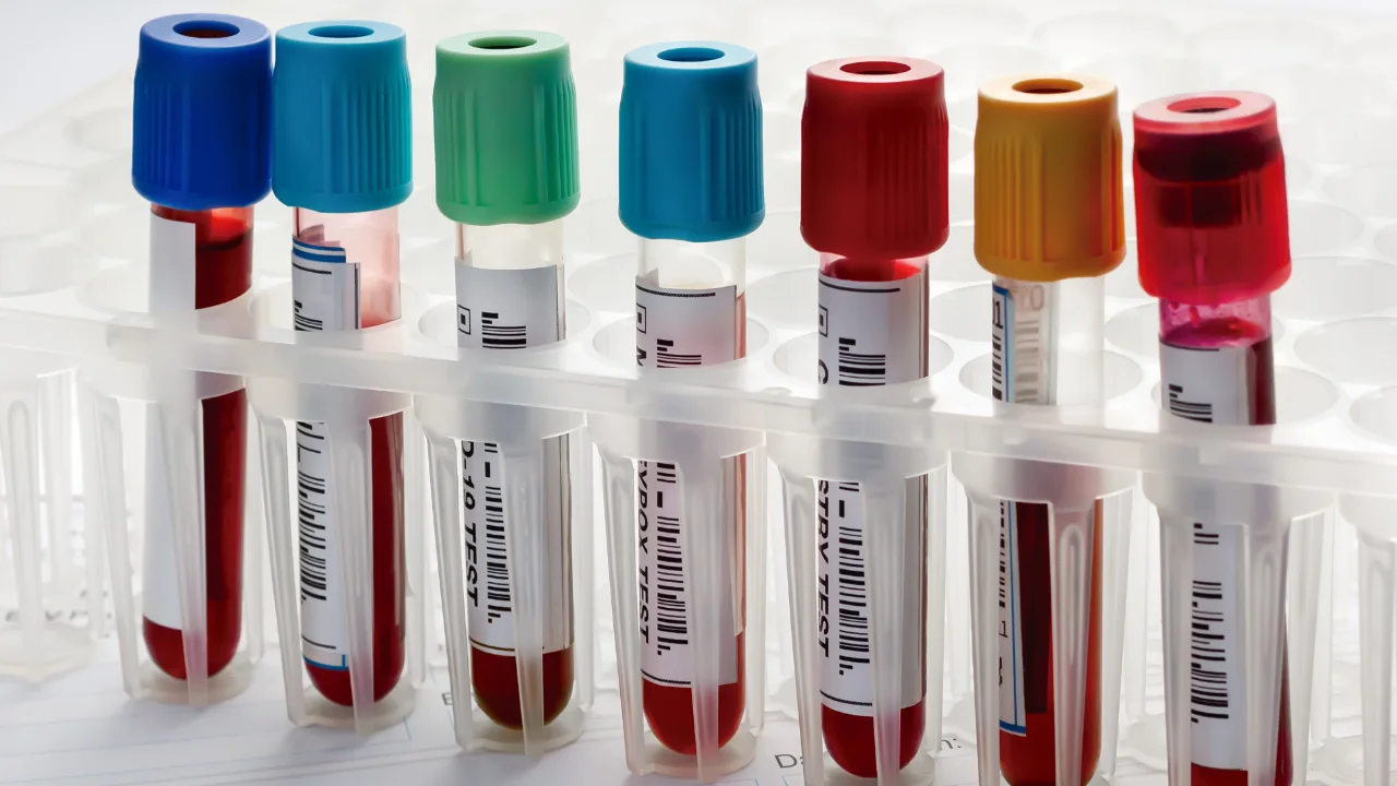 Recommended lab work